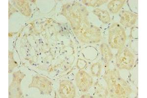 Immunohistochemistry of paraffin-embedded human kidney tissue using ABIN7170959 at dilution of 1:100 (SULT1C2 anticorps  (AA 1-120))
