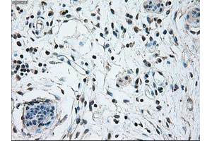 Immunohistochemical staining of paraffin-embedded breast tissue using anti-NRBP1 mouse monoclonal antibody. (NRBP1 anticorps)