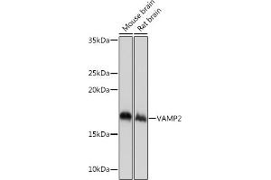 Western blot analysis of extracts of various cell lines, using V Rabbit mAb (ABIN7271313) at 1:1000 dilution.