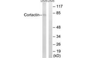 Western blot analysis of extracts from LOVO cells, using Cortactin (Ab-466) Antibody. (Cortactin anticorps  (AA 441-490))