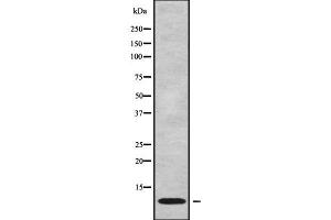 Western blot analysis NDUFC1 using Jurkat whole cell lysates (NDUFC1 anticorps  (C-Term))