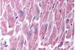 Human Heart (formalin-fixed, paraffin-embedded) stained with KCNQ2 antibody ABIN214789 at 5 ug/ml followed by biotinylated goat anti-rabbit IgG secondary antibody ABIN481713, alkaline phosphatase-streptavidin and chromogen.