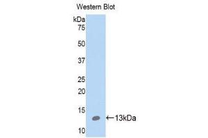 Western Blotting (WB) image for anti-S100 Calcium Binding Protein A10 (S100A10) (AA 1-96) antibody (ABIN1078494) (S100A10 anticorps  (AA 1-96))