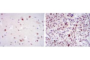 Immunohistochemical analysis of paraffin-embedded brain tissues (left) and esophageal cancer tissues (right) using CDK9 mouse mAb with DAB staining.