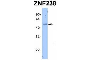 Host:  Rabbit  Target Name:  ZNF238  Sample Type:  Human Fetal Heart  Antibody Dilution:  1. (ZNF238 anticorps  (N-Term))