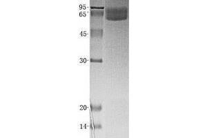 Validation with Western Blot (VNN1 Protein (His tag))
