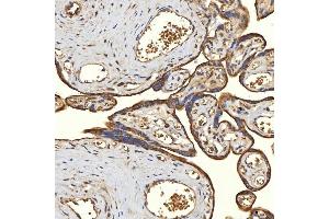 IHC analysis of TST using anti-TST antibody (ABIN7599105). (TST anticorps  (AA 1-220))