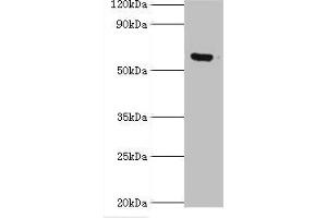 Western blot All lanes: MKS1 antibody at 6 μg/mL + Hela whole cell lysate Secondary Goat polyclonal to rabbit IgG at 1/10000 dilution Predicted band size: 65, 60, 64 kDa Observed band size: 65 kDa (MKS1 anticorps  (AA 150-300))