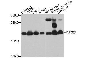 Western blot analysis of extracts of various cell lines, using RPS24 antibody. (RPS24 anticorps  (AA 1-130))