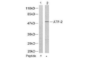 Image no. 2 for anti-Activating Transcription Factor 2 (ATF2) (Thr55), (Thr73) antibody (ABIN197150) (ATF2 anticorps  (Thr55, Thr73))
