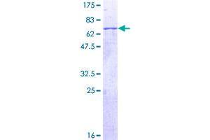Image no. 1 for Hyaluronidase-3 (HYAL3) (AA 1-417) protein (GST tag) (ABIN1307304)