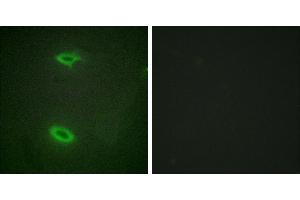Peptide - +Western blot analysis of extracts from HepG2 cells, using DLGP1 antibody. (DLGAP1 anticorps  (Internal Region))