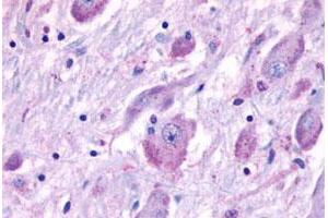Immunohistochemical staining of human brain with CELSR1 polyclonal antibody . (CELSR1 anticorps  (N-Term))