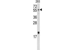 Western Blotting (WB) image for anti-Bone Morphogenetic Protein 10 (BMP10) antibody (ABIN5018806) (BMP10 anticorps)