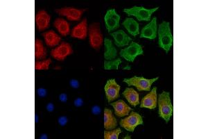 IL4I1 Antibody staining HepG2 cells by IF/ICC.