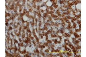 Image no. 2 for anti-Keratin 18 (KRT18) (AA 1-431) antibody (ABIN598778) (Cytokeratin 18 anticorps  (AA 1-431))