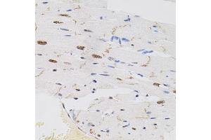 Immunohistochemistry of paraffin-embedded rat heart using FAF1 antibody (ABIN5975642) (40x lens). (FAF1 anticorps)