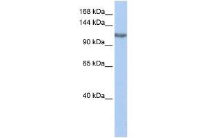 WB Suggested Anti-TGS1 Antibody Titration:  0. (TGS1 anticorps  (Middle Region))