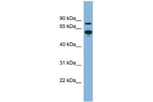 ABCF2 antibody used at 1 ug/ml to detect target protein. (ABCF2 anticorps)