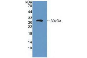 Figure. (ABCC3 anticorps  (AA 1291-1523))