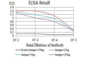 Black line: Control Antigen (100 ng),Purple line: Antigen (10 ng), Blue line: Antigen (50 ng), Red line:Antigen (100 ng)