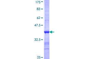 Protein S (PROS) (AA 419-516) protein (GST tag)