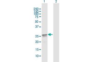 Western Blot analysis of C17orf66 expression in transfected 293T cell line by C17orf66 MaxPab polyclonal antibody. (C17orf66 anticorps  (AA 1-219))