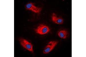 Immunofluorescent analysis of S6K1 (pS434) staining in K562 cells. (RPS6KB1 anticorps  (C-Term, pSer434))
