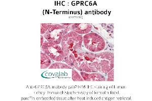 Image no. 1 for anti-G Protein-Coupled Receptor, Family C, Group 6, Member A (GPRC6A) (Extracellular Domain), (N-Term) antibody (ABIN1735226) (GPRC6A anticorps  (Extracellular Domain, N-Term))
