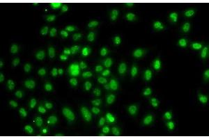 Immunofluorescence analysis of A549 cells using FOXN2 Polyclonal Antibody (FOXN2 anticorps)