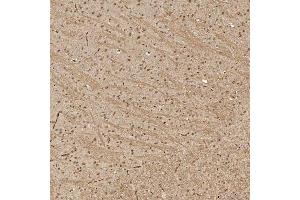 IHC analysis of Sm-D3/SNRPD3 using anti-Sm-D3/SNRPD3 antibody (ABIN7598952).