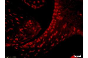 Formalin-fixed and paraffin embedded Lymphocytes labeled with (ABIN672936) Rabbit Anti-CD4 Polyclonal Antibody, Unconjugated followed by conjugation to the secondary antibody.