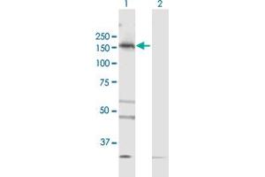 Western Blot analysis of TBC1D1 expression in transfected 293T cell line by TBC1D1 MaxPab polyclonal antibody. (TBC1D1 anticorps  (AA 1-1168))