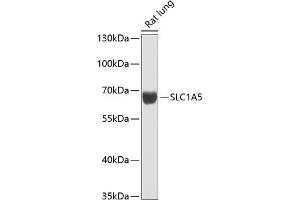 Western blot analysis of extracts of rat lung, using SLC1 antibody (ABIN6128765, ABIN6147874, ABIN6147876 and ABIN6216404) at 1:1000 dilution. (SLC1A5 anticorps  (AA 1-100))