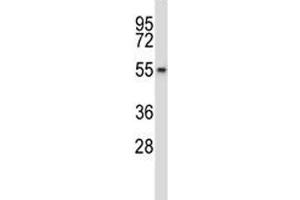 Wee2 antibody western blot analysis in HepG2 lysate.