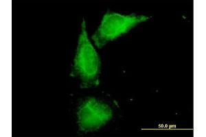 Immunofluorescence of purified MaxPab antibody to UMOD on HeLa cell. (Uromodulin anticorps  (AA 1-611))