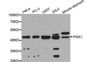 Western blot analysis of extracts of various cell lines, using PGK1 antibody (ABIN5971017) at 1/1000 dilution.