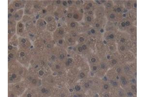 Detection of SIRT3 in Mouse Liver Tissue using Polyclonal Antibody to Sirtuin 3 (SIRT3) (SIRT3 anticorps  (AA 5-257))