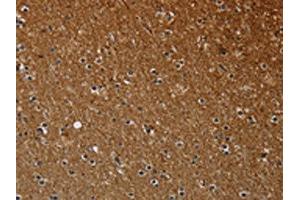 The image on the left is immunohistochemistry of paraffin-embedded Human brain tissue using ABIN7191586(NCKAP1 Antibody) at dilution 1/30, on the right is treated with synthetic peptide. (NCKAP1 anticorps)