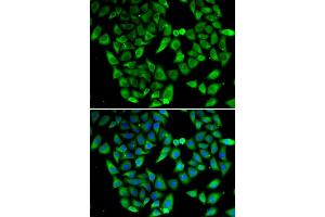 Immunofluorescence analysis of HeLa cells using ASIP antibody. (ASIP anticorps)