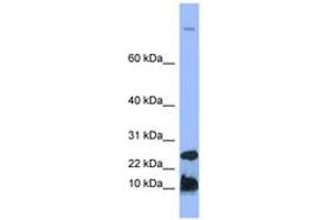 Image no. 1 for anti-Hepcidin Antimicrobial Peptide (HAMP) (N-Term) antibody (ABIN6741742) (Hepcidin anticorps  (N-Term))