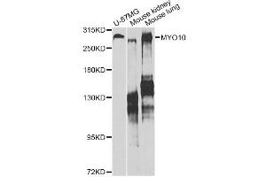 Western blot analysis of extracts of various cell lines, using MYO10 antibody. (Myosin X anticorps)