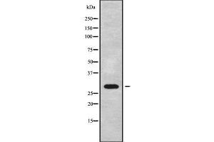 Western blot analysis of EIF3J using A549 whole cell lysates (EIF3S1 anticorps  (Internal Region))