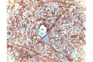 Immunohistochemical staining for Munc-18 on a formalin-fixed, paraffin-embedded rat brain section with citrate buffer pretreatment (40X magnification). (STXBP1 anticorps  (AA 18-1))