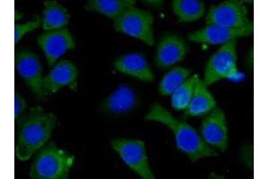 Detection of CAP3 in Human Hela Cell using Polyclonal Antibody to Cytoplasmic Antiproteinase 3 (CAP3) (SERPINB9 anticorps  (AA 1-376))