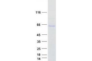 Validation with Western Blot