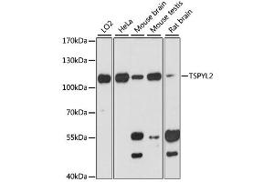 Western blot analysis of extracts of various cell lines, using TSPYL2 antibody (ABIN6291999) at 1:3000 dilution. (TSPY-Like 2 anticorps)