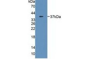 Detection of Recombinant MDH2, Human using Polyclonal Antibody to Malate Dehydrogenase 2 (MDH2) (MDH2 anticorps  (AA 25-338))