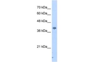Western Blotting (WB) image for anti-Interaction Protein For Cytohesin Exchange Factors 1 (IPCEF1) antibody (ABIN2462961) (ICEF1 anticorps)