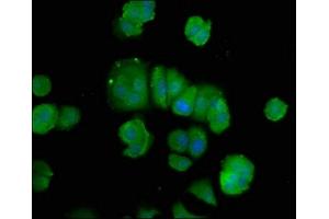 Immunofluorescence staining of MCF-7 cells with ABIN7150235 at 1:100, counter-stained with DAPI. (POLD3 anticorps  (AA 203-275))